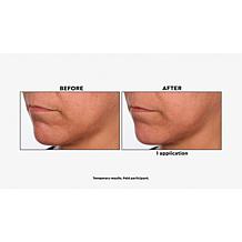 Skinn® Cosmetics DermAppeal® Microderm Beauty Treatment