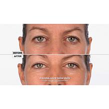 Skinn® Cosmetics DWP Eye Creme Reverse Intensive