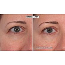 Skinn® Cosmetics DWP Eye Creme Reverse Intensive