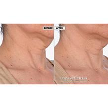 Skinn Cosmetics Neck Amour Defining Serum Auto-Ship®