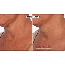 Skinn Cosmetics Neck Amour Defining Serum