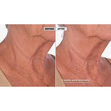 Skinn Cosmetics Neck Amour Redensifying Serum