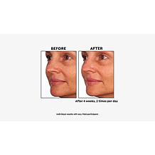 Skinn® Cosmetics Non-Negotiables Multi-Acid Resurfacing Pads