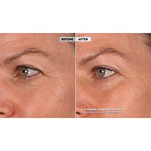 SKINN DWP Eye Creme Reverse Intensive 2-pack Auto-Ship®