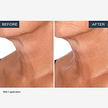 SKINN Neck Amour Advanced Leave-on Mask 1.7 fl. oz.