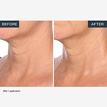 SKINN Neck Amour Advanced Leave-on Mask 1.7 fl. oz.
