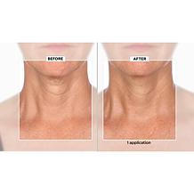 SKINN Neck Amour Advanced Leave-on-Mask & Facial Massage Tool