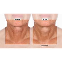 SKINN Neck Amour Advanced Leave-on-Mask & Facial Massage Tool AS