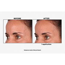 SKINN Non-Negotiables DermAppeal and Glass Effect Treatment Balm Set