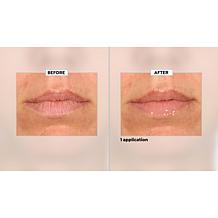 SKINN Non-Negotiables Lip 6x Lip Amplifying Serum Auto-Ship®