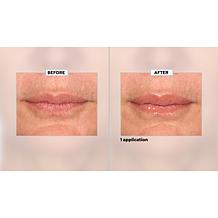 SKINN Non-Negotiables Lip 6x Lip Amplifying Serum Auto-Ship®