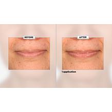 SKINN Non-Negotiables Lip 6x Lip Amplifying Serum Auto-Ship®