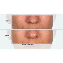 SKINN Non-Negotiables Mantle Milk Skin Flooding Serum Auto-Ship®