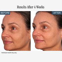 SKINN Non-Negotiables Resurfacing Pads & Headband Duo - Auto-Ship®