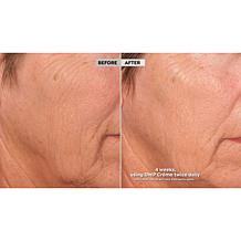 SKINN Supersize DWP Protocol Creme Reverse Intensive