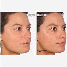 SKINN Supersize Luminous Facial Oil and Reusable Gold Eye Patches 