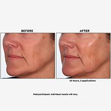 SKINN Supersize Luminous Facial Oil and Reusable Gold Eye Patches 