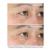 StriVectin Contour Restore Moisturizing Eye Balm