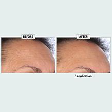 The Beauty Spy Dr. Tree Super Collagen PDRN Wrinkle Patches