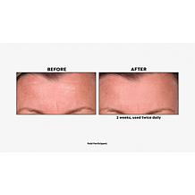 The Beauty Spy Neogen SURMEDIC™ Super Peptide Collagen Serum