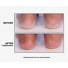 The Beauty Spy Richenna Jumbo EZ Body Foot Peel