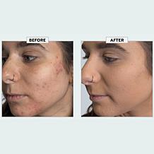 Youngblood
Loose Mineral Foundation & Brush Set