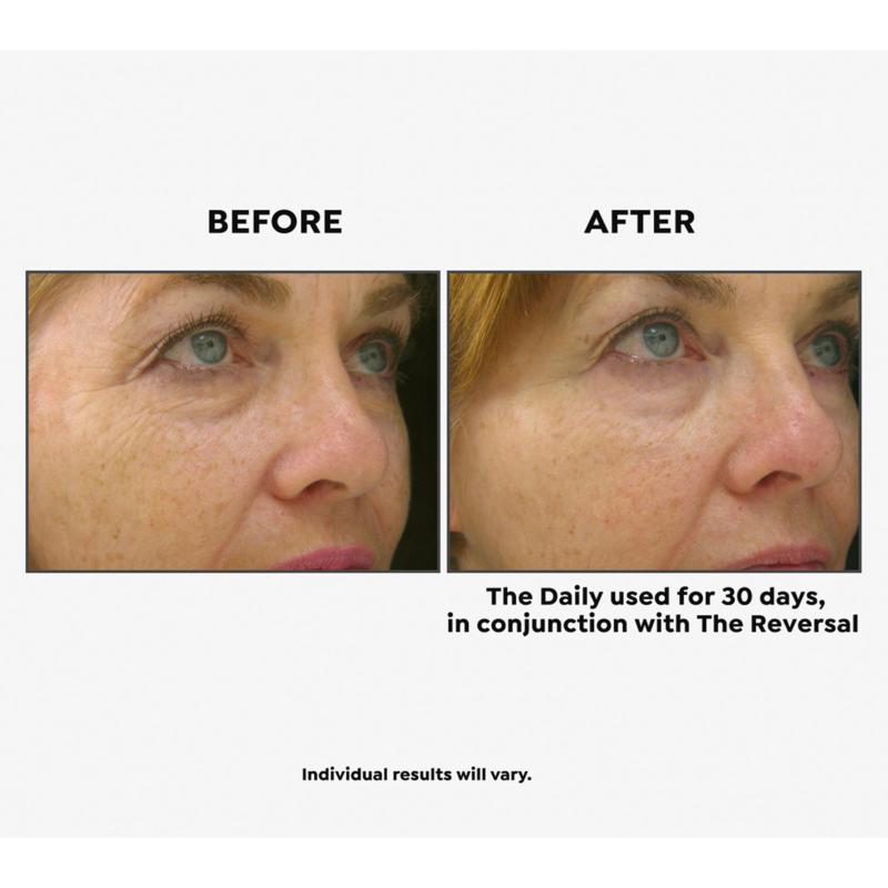 (HSN) BeautyBio R45 The Reversal Retinol + The Daily 2pack