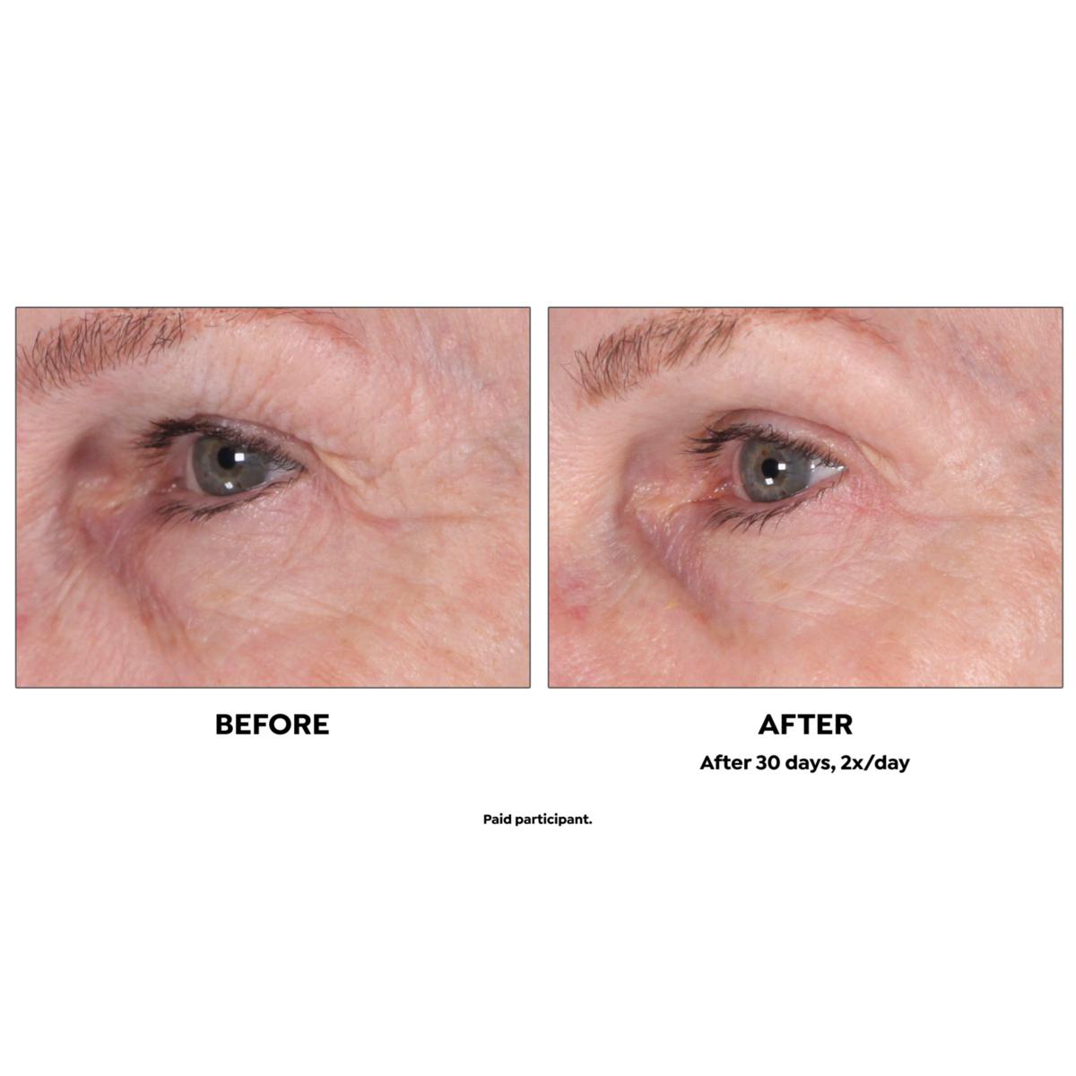 Active Argan 1.7 oz. 24K Stem Cell Eye Cream | HSN