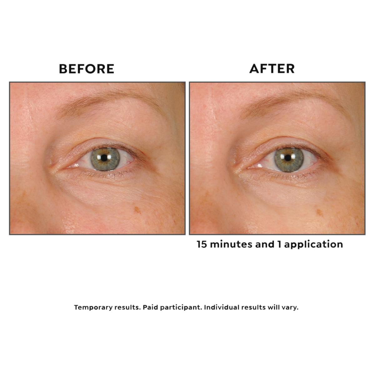 BIOBEAUTY Bio Peeling 5パック BeautyBio x G by Giuliana GloPRO & Bright Eyes Patches with