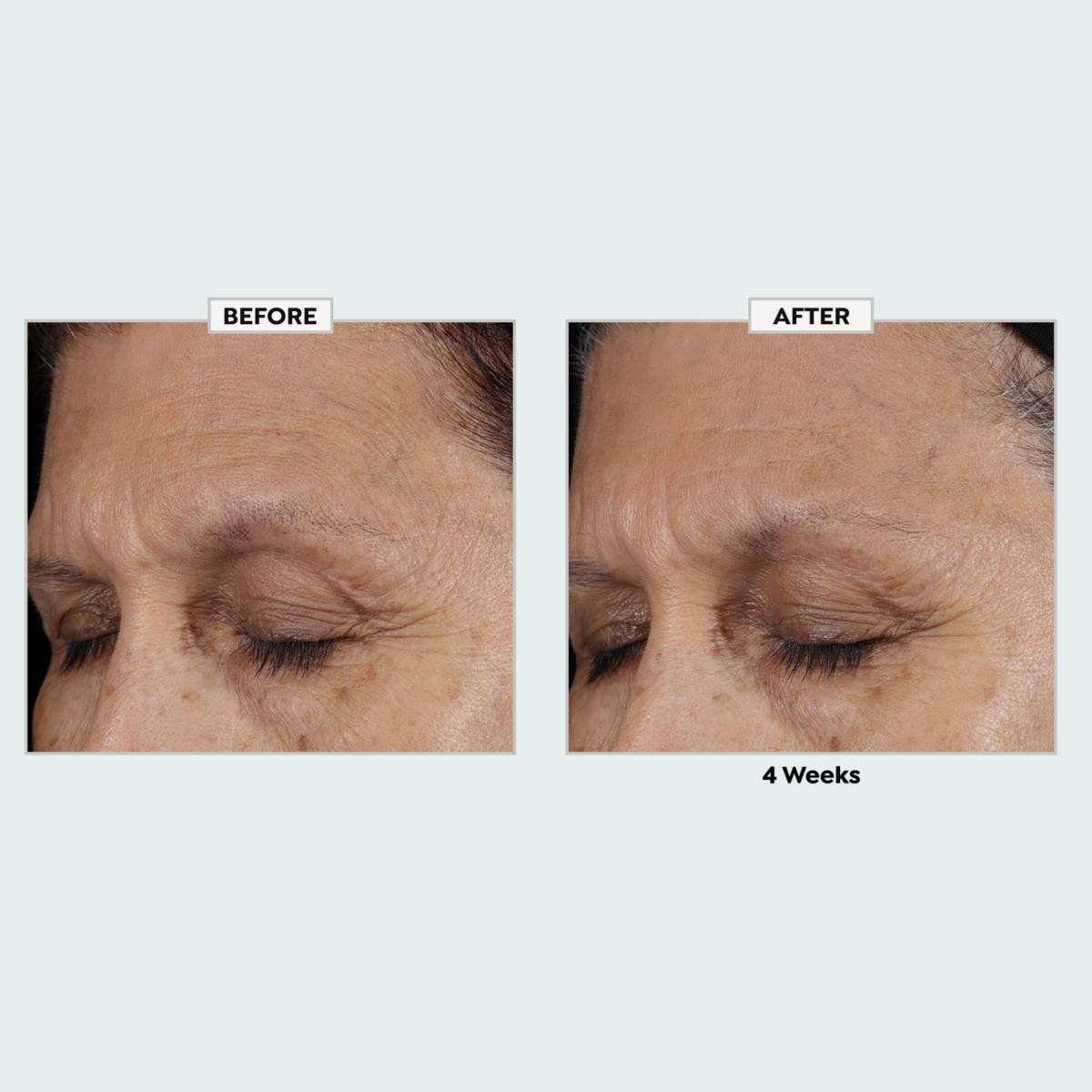 isomers glutathione serum Isomers Skincare Glutathione Antioxidant Serum & Deep Crease Cream