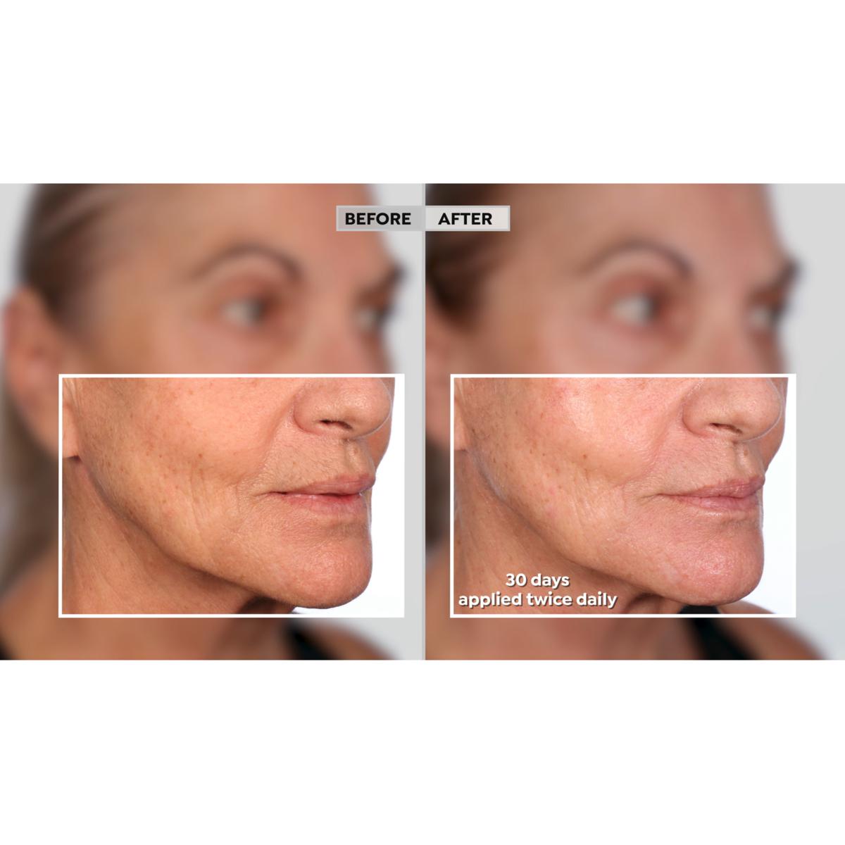 Lancôme Renergie HPN 300 Peptide Cream & Triple Serum w/Cosmetic