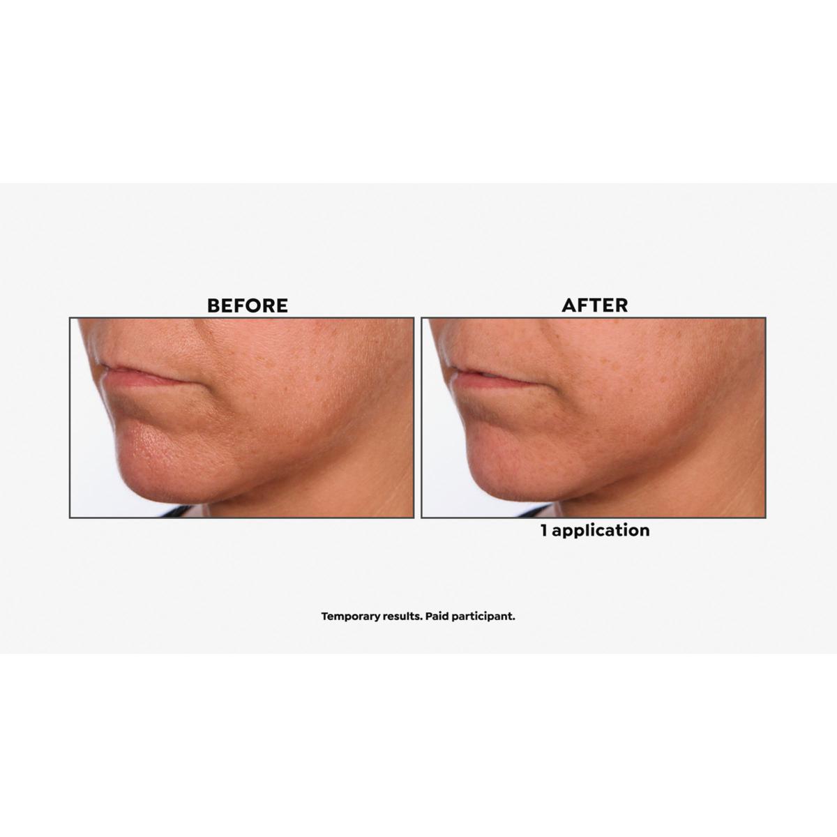 Skinn® Cosmetics DermAppeal® Microderm Beauty Treatment | HSN