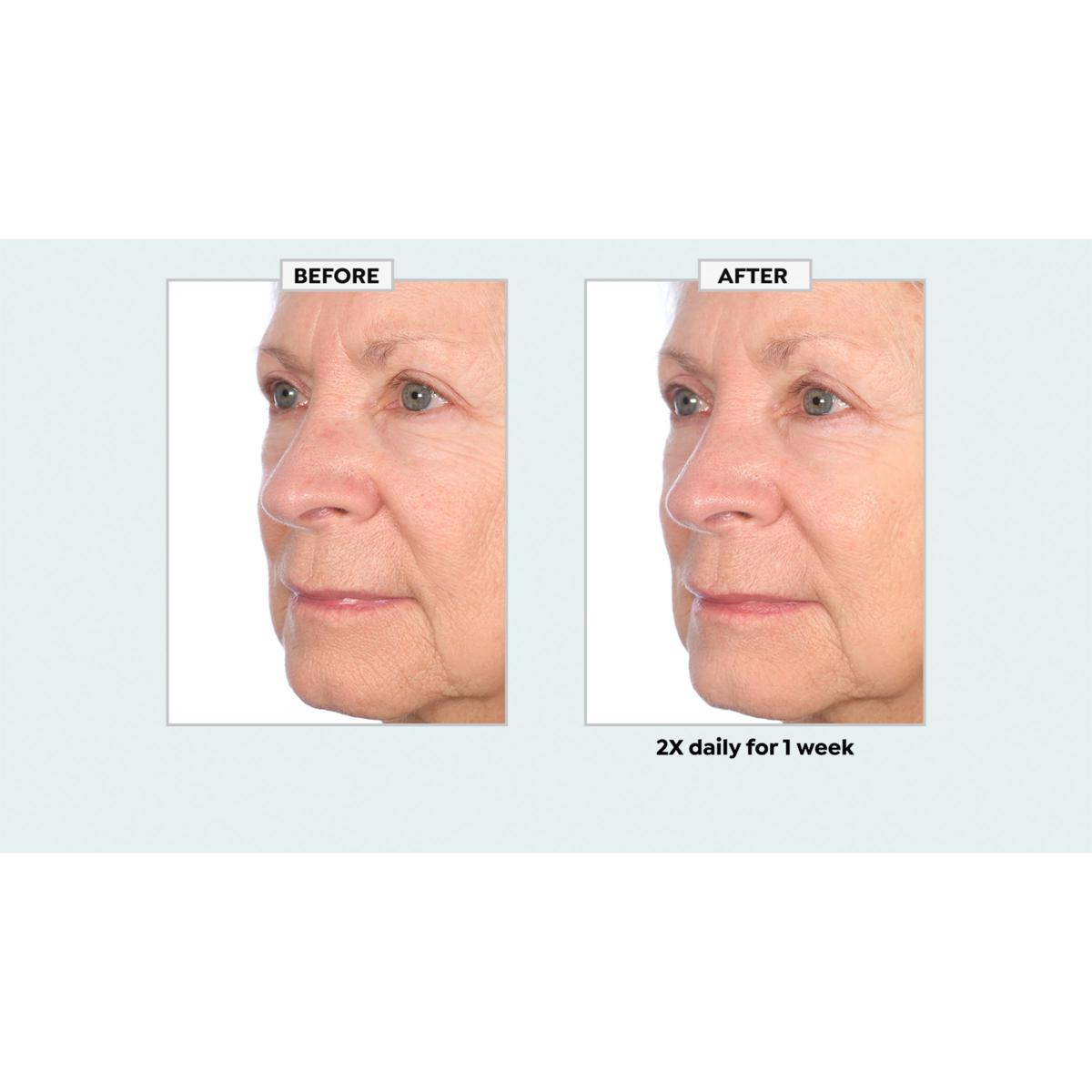 美容皮膚医学BEAUTY #13(Vol.2 No.12 HydraBeauty2 - Medicare