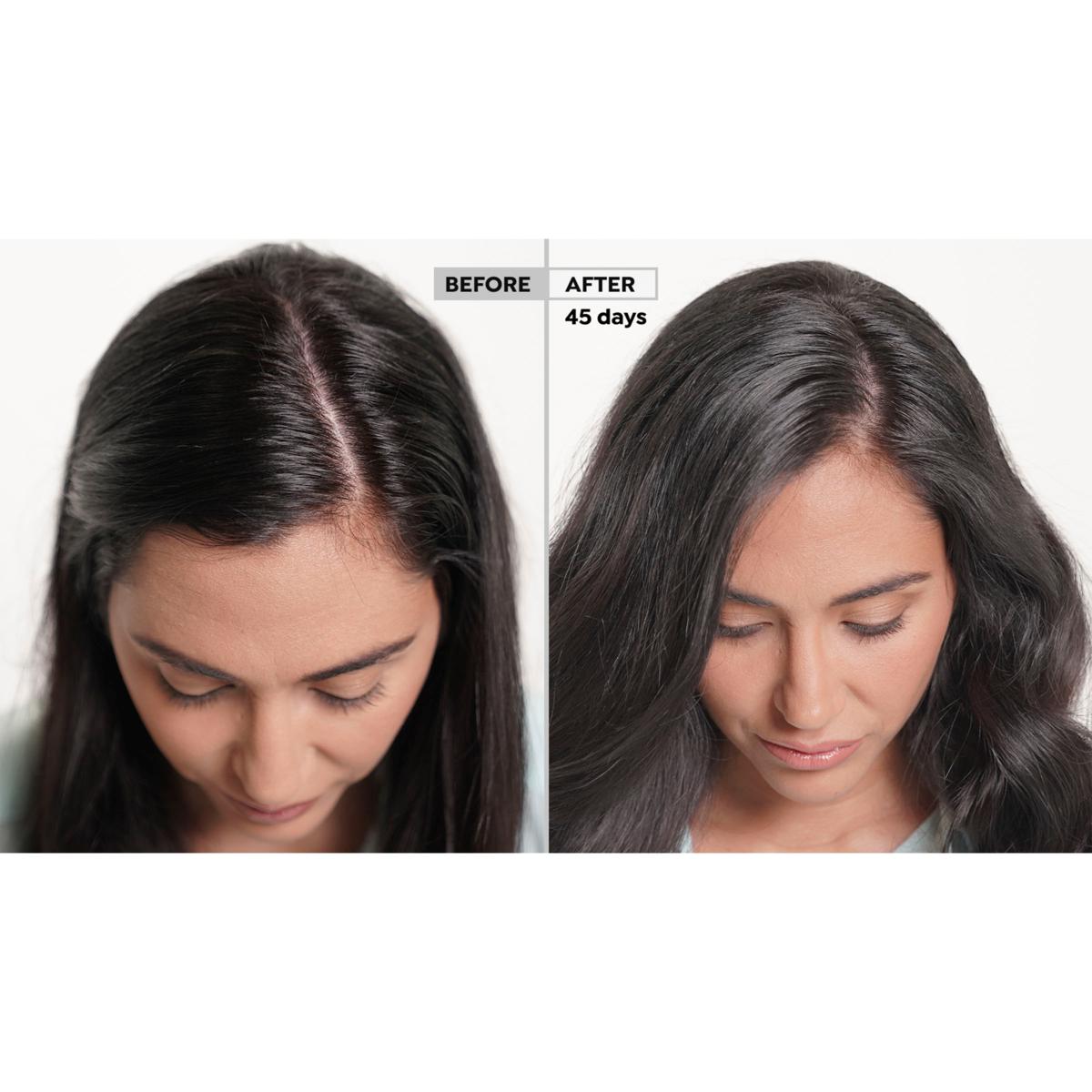 Xcellerate Plus Hair Serum Minoxidil 2 Hair Regrowth Set 23439614 HSN